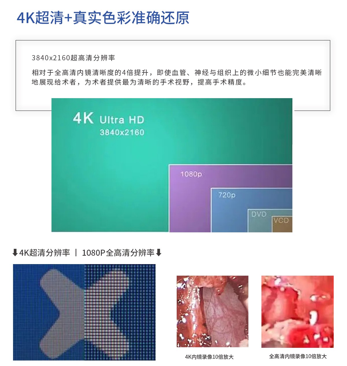 【4K醫用內窺鏡攝像系統】您的第一臺“4K”找到了嗎？