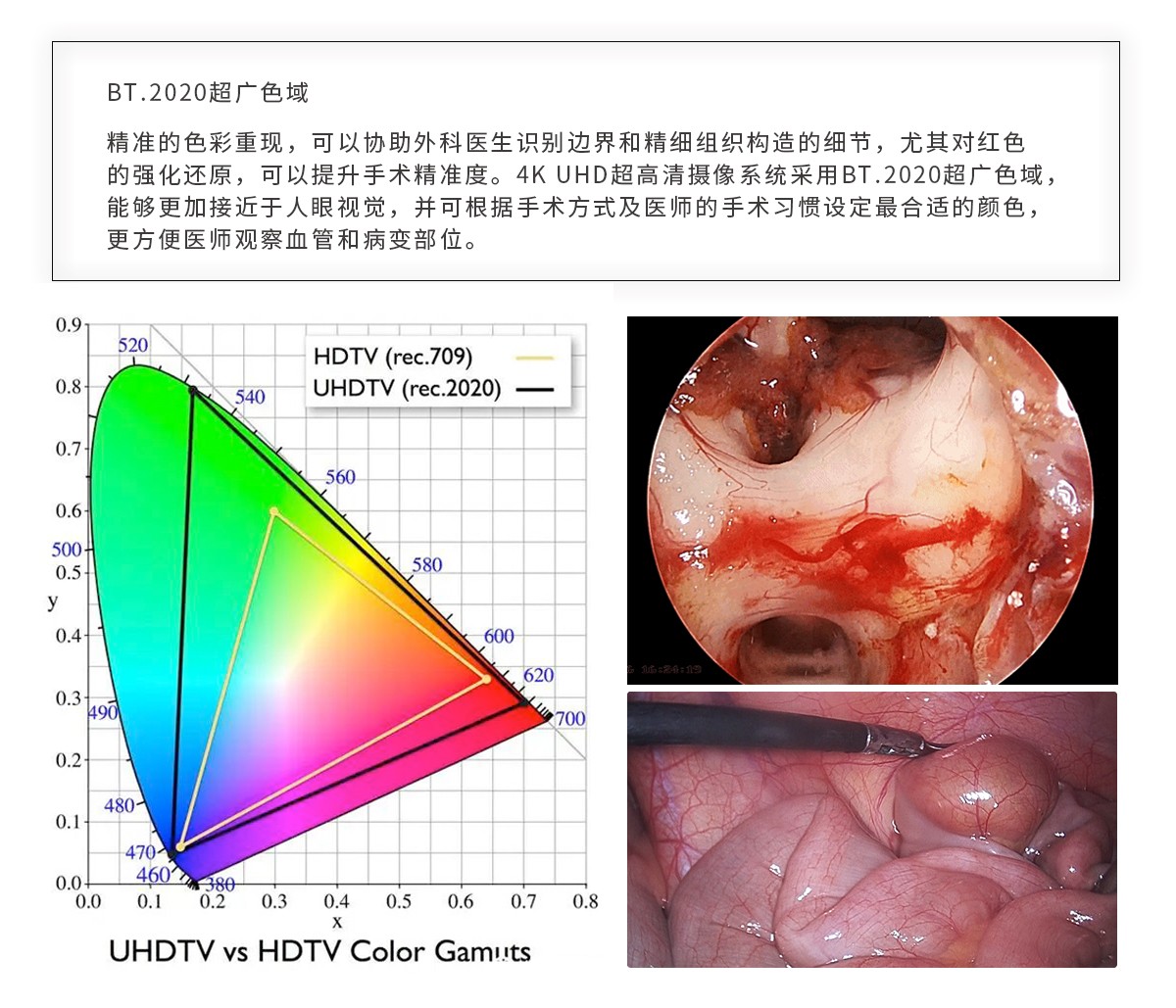 【4K醫用內窺鏡攝像系統】您的第一臺“4K”找到了嗎？