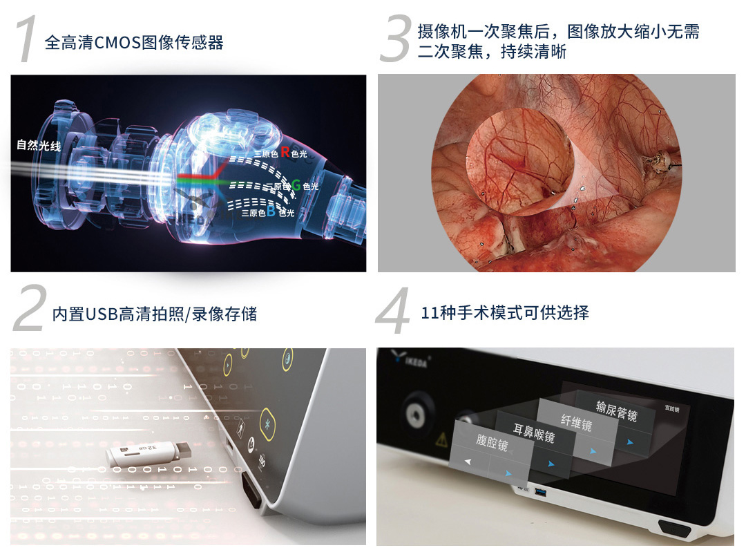 YKD-9106 一體化內窺鏡影像系統