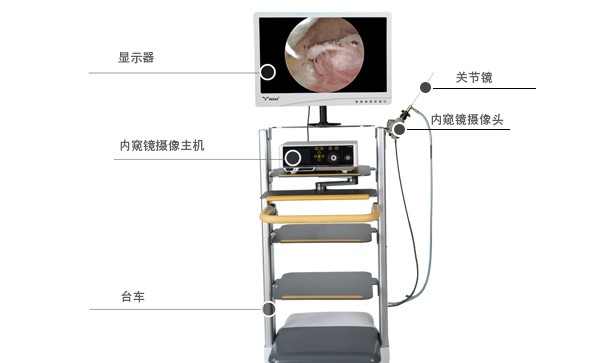 了解關節鏡以及關節鏡適應癥